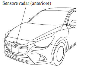 Sensore radar (Anteriore)*